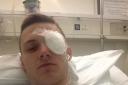Ryan Warren, 18, has undergone an operation to reattach the retina in his left eye after being hit with a glass bottle.