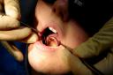 A study has found no dentists in Norfolk accepting new NHS patients