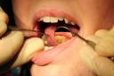 West Earlham Dental Health Practice is offering free dental check-ups for children