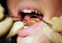 Councillors are calling for action to tackle high rates of tooth decay in the county