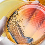 The Earlham Institute has undertaken an analysis of 10,000 Salmonella strains as part of a worldwide project to understand how Salmonella develops and is transmitted   Picture: Getty Images/iStockphoto